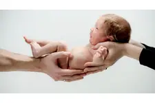 Yenidoğanda Kistik Fibrozis Belirtileri ve Tedavisi